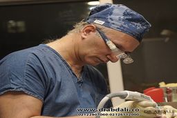 نکاتی که قبل از کاشت موی طبیعی باید بدانیم
