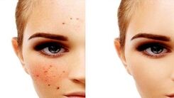 هنگام خرید ضد لک به چه نکاتی توجه کنیم؟