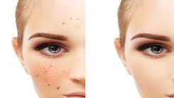 هنگام خرید ضد لک به چه نکاتی توجه کنیم؟