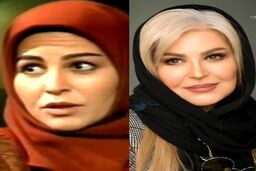 داغون شدن چهره اکرم محمدی بعد از عمل زیبایی +عکس