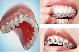 ارتودنسی دندان چگونه است؟