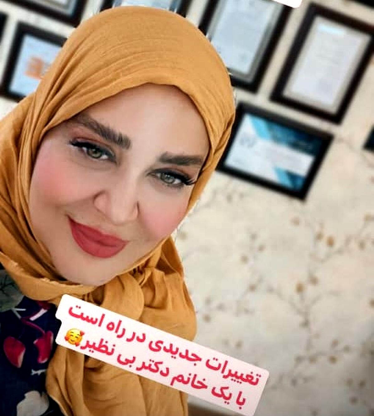 خل شدن بهاره رهنما بعد از طلاق دومش | تیپ اجق وجق بهاره رهنما در پارک +عکس حاشیه ساز