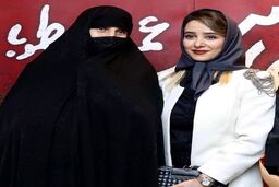 چهره ترسناک الناز حبیبی | بلایی که  خانم بازیگر سر چهره اش آورد + عکس