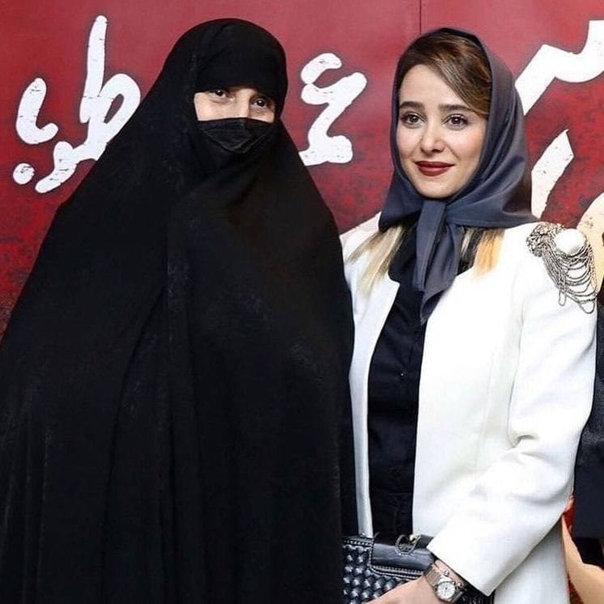 چهره ترسناک الناز حبیبی | بلایی که  خانم بازیگر سر چهره اش آورد + عکس
