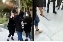 هلیا قمه کش را عمرا بشناسید ! | فیلم هلیا دختر دهه هشتادی بعد از عمل زیبایی بینی! | هلیا بلاگر می شود؟ 