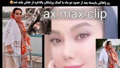 دختری که در حادثه متروپل از مرگ نجات یافته بود امروز برای اولین بار راه رفت! + عکس