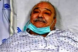 محمد کاسبی دوباره در سی سی یو بستری شد