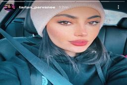 شاید باور نکنید این خانم ترلان پروانه باشه | چهره وحشتناک ترلان پروانه در نوجوانی! +عکس