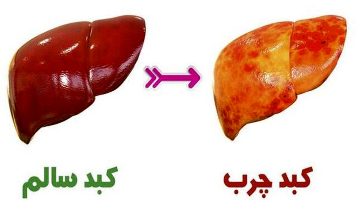 قاتل فوری کبدچرب | پاکسازی و تقویت کبد با این میوه خوشمزه
