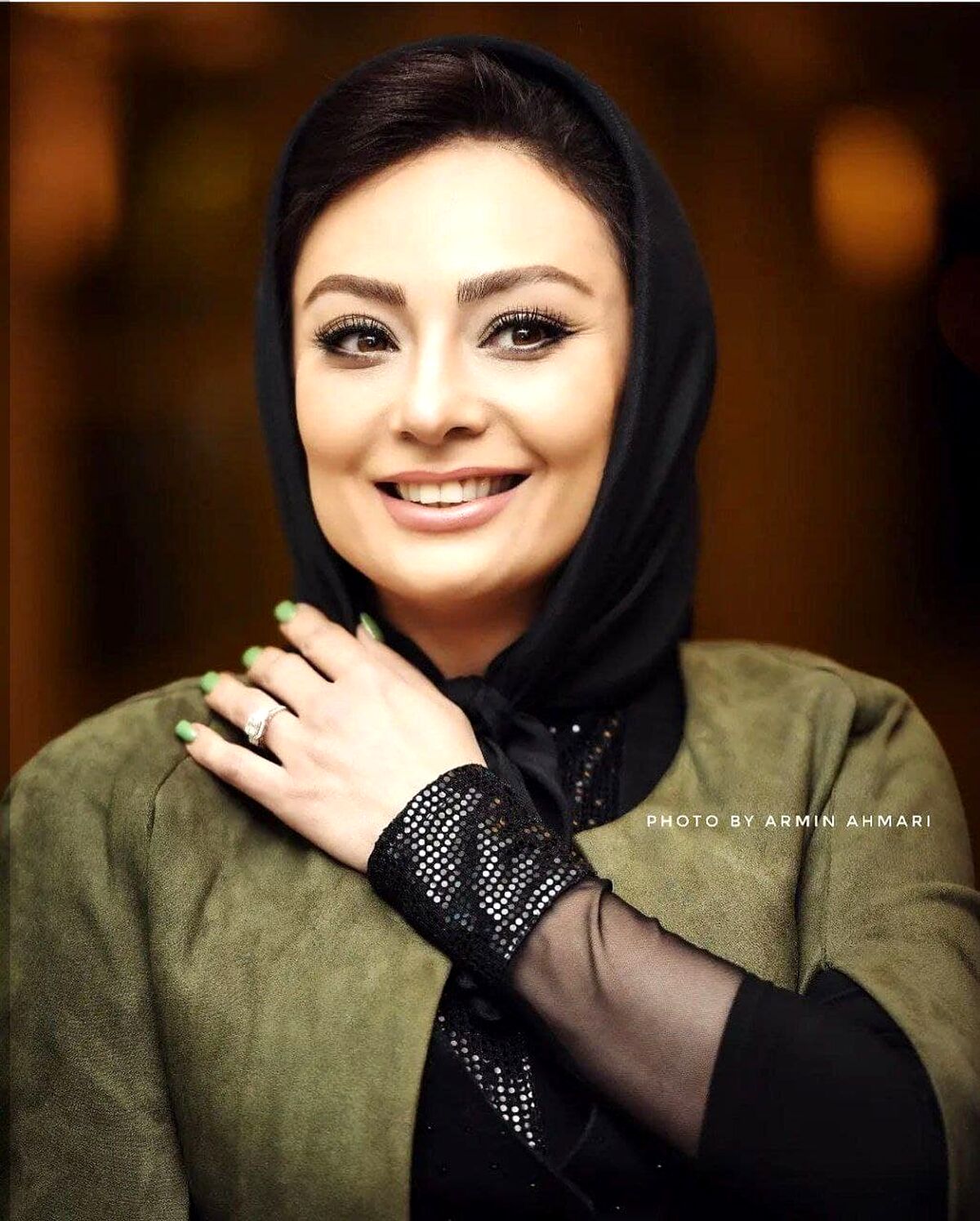 سفید شدن ناگهانی موهای همسر معروف یکتا ناصر همه را شوکه کرد/فشار زندگی و ریخت و پاش های یکتا ناصر شوهرش را پیر کرد! +عکس خبرساز