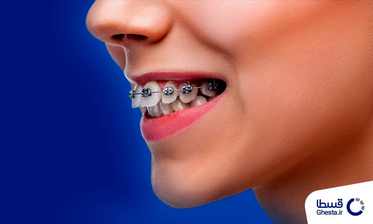 پرداخت اقساطی هزینه انواع خدمات با قسطا کارت