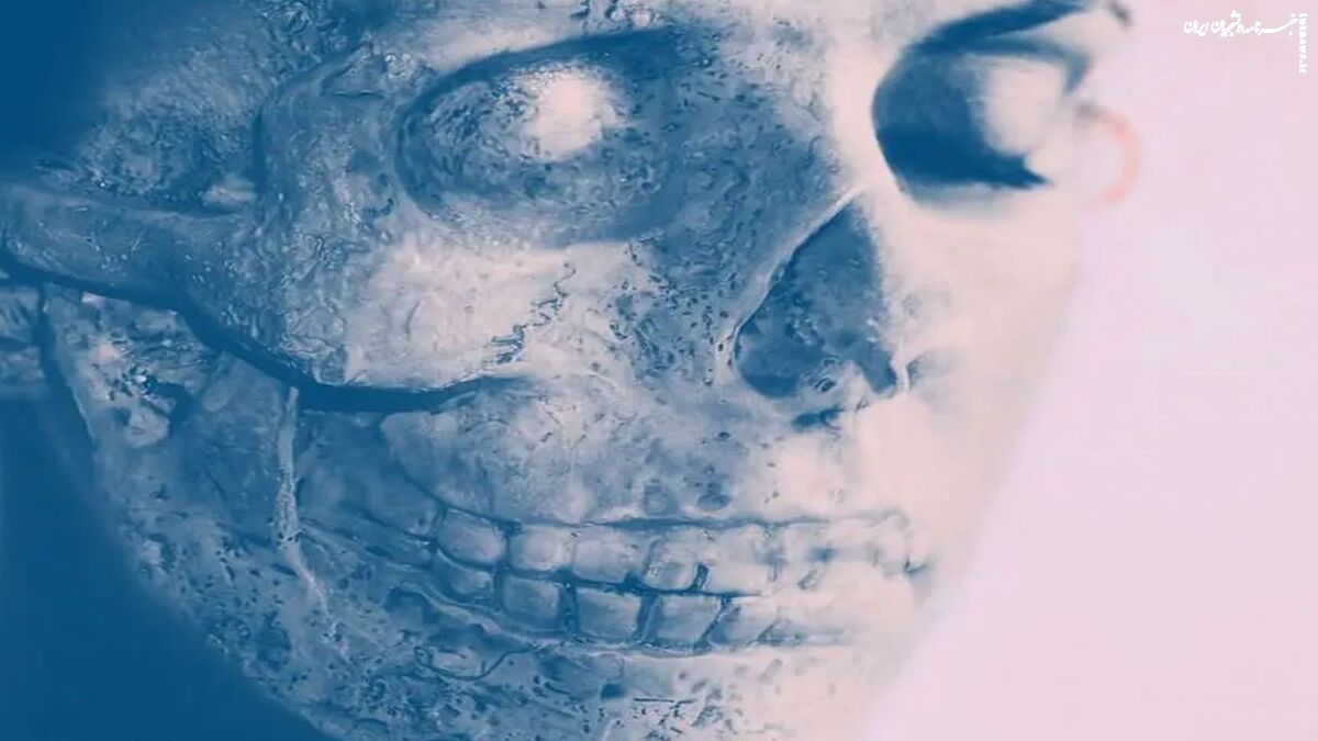 مرده متحرک در دنیای واقعی | سندروم مرده متحرک را بشناسید