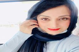 صبا راد هر روز عملی تر از دیروزش | صباراد با عمل زیبایی جدیدش بیست سال جوان تر شد + عکس