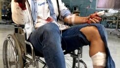 فوتبالیست معروف سلاخی شد/ سارقان او را با چاقو سلاخی کردن