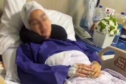 حمله دلخراش سگ پیت بول به یک زن در شهرک غرب | تصاویر زن جوان پس از حمله هولناک سـگ لاکچری