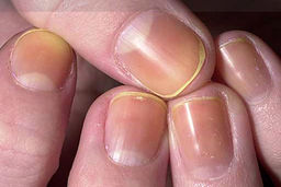 علامت عجیب و کلیدی اُمیکرون