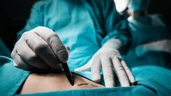 مرگ وحشتناک زن جوان به خاطر ۱۵ کیلو اضافه‌وزن