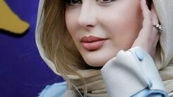 ادعای جنجالی نیوشا ضیغمی بعد عمل جدید بینی اش | فحش و فحش کاری نیوشا ضیغمی و شیلا خداداد سر بینی! | خانم بازیگر  آخر سر مدرکش را رو کرد +عکس