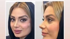 واکنش عجیب مانی رهنما به عمل زیبایی همسرش صبا راد | درگیری صبا راد با همسرش به فضای مجازی کشیده شد +عکس