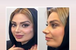 واکنش عجیب مانی رهنما به عمل زیبایی همسرش صبا راد | درگیری صبا راد با همسرش به فضای مجازی کشیده شد +عکس