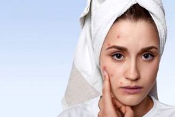 نابودی جوش صورت در یک روز