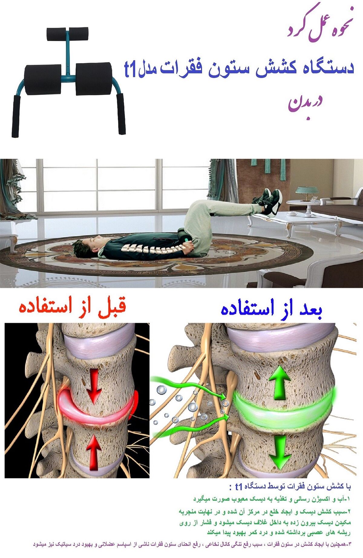 جدید ترین درمان انواع کمردرد و گردن درد