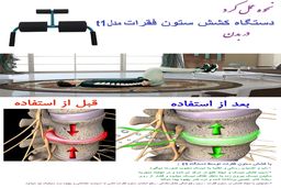 جدید ترین درمان انواع کمردرد و گردن درد