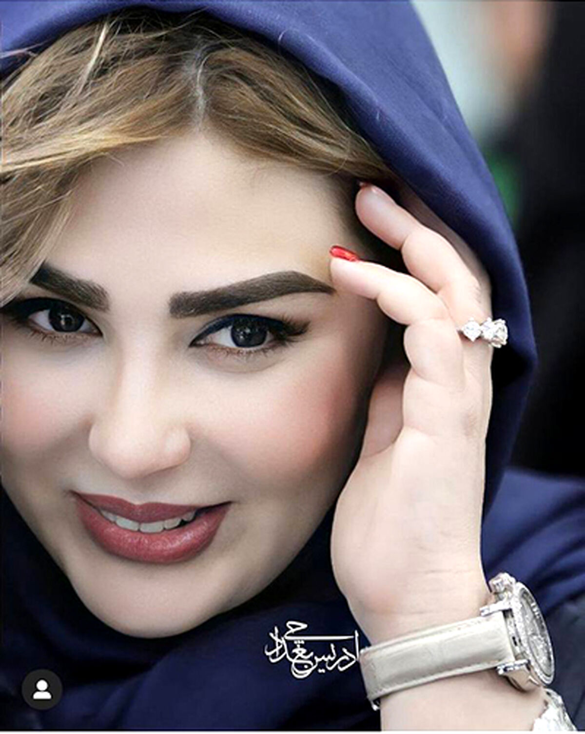 کتک کاری همسر نیوشا ضیغمی او را راهی خیابان کرد | عکس وحشتناک بعد از کتک کاری همسر نیوشا ضیغمی 