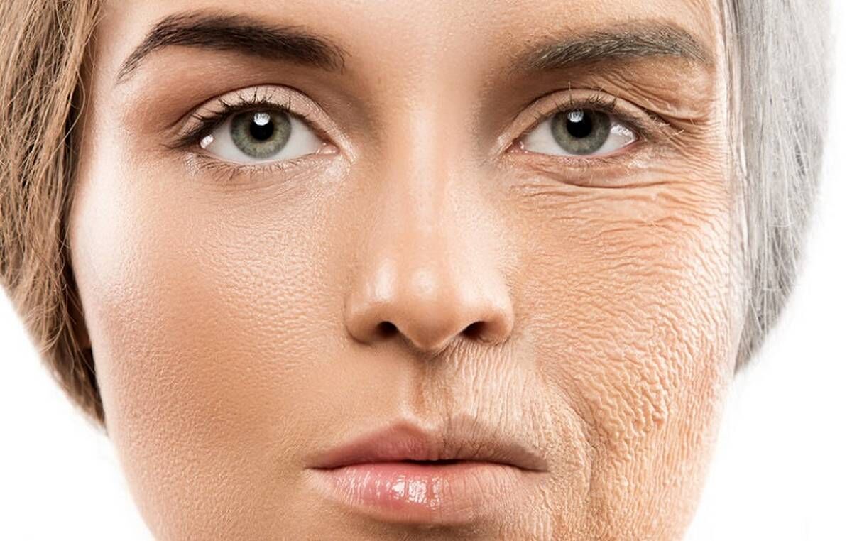 شایع ترین عوامل پیری زودرس پوست | چه کار کنیم تا زود پیر نشویم ؟