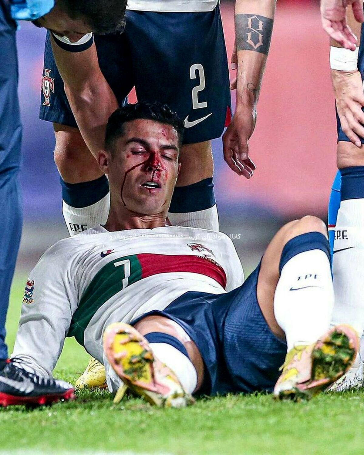 صورت رونالدو خونین شد +عکس