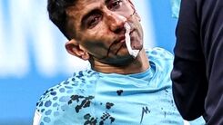 تصمیم عجیب و غریب بیرانوند در جام جهانی جنجال به پا کرد !