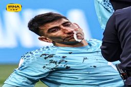 آخرین وضعیت علیرضا بیرانوند با بینی شکسته | گلر ایران به بازی با ولز می‌رسد؟