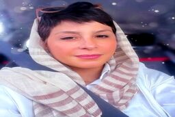 شاید سیما تیرانداز را قبل از عمل های زیباییش ندیده باشید | تغییرات شوکه کننده چهره سیما تیرانداز +عکس