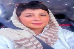 شاید سیما تیرانداز را قبل از عمل های زیباییش ندیده باشید | تغییرات شوکه کننده چهره سیما تیرانداز +عکس