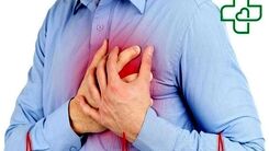 هر آن چیز که باید و واجب است! از سکته قلبی بدانیم