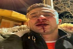 بازداشت بازیکن سابق پرسپولیس/چهر خونین مدیر تیم شهر خودرو +عکس