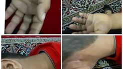 شکنجه دانش آموز کلاس اولی توسط معلم سنگدل +عکس