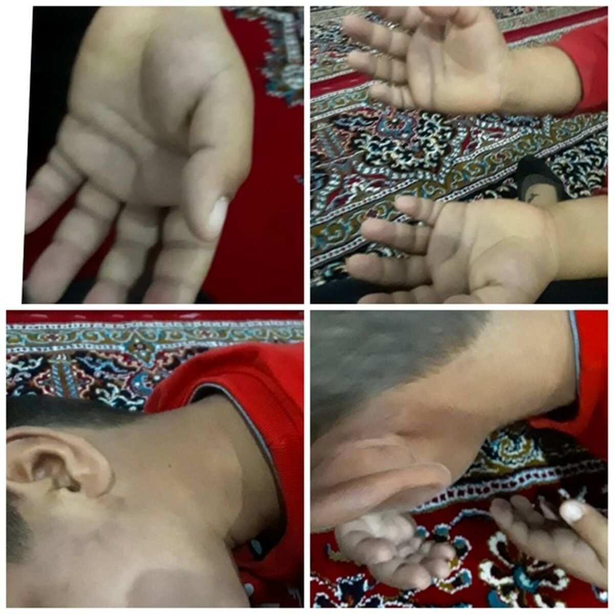 شکنجه دانش آموز کلاس اولی توسط معلم سنگدل +عکس