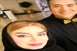 صبا راد با عمل زیبایی جدید مثل همه عملی ها شد | خانم صبا راد به نظرت بس نیست؟