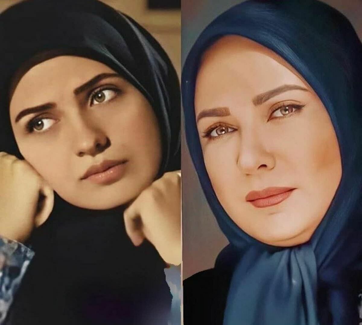 اتفاق وحشتناک اسید پاشی امروز صبح برای لعیا زنگنه | چهره لعیا زنگنه دیگر قابل شناسایی نیست +عکس (18+) از لعیا زنگنه