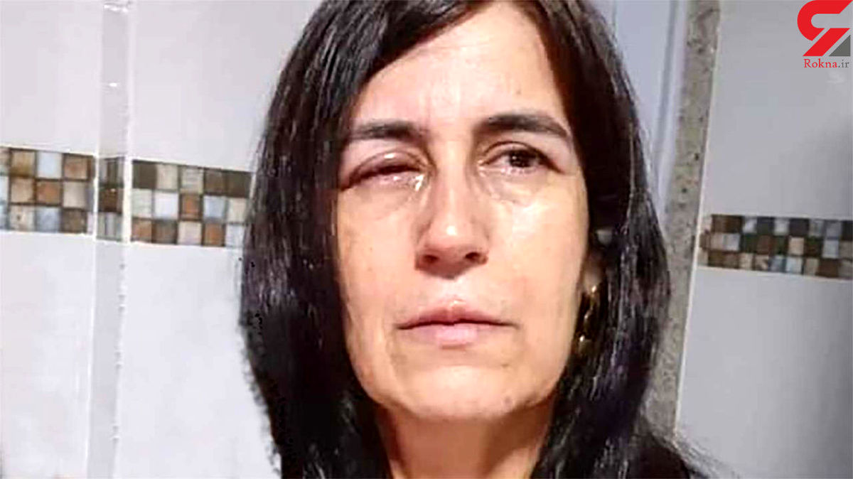 اشتباه وحشتناک یک مرد زنش را کور کرد+عکس