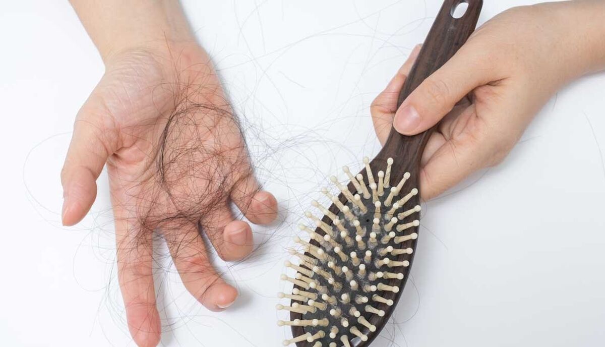 اگر ریزش مو دارید بخوانید | کمبود ویتامین‌ها چگونه باعث ریزش مو می‌شود ؟ 